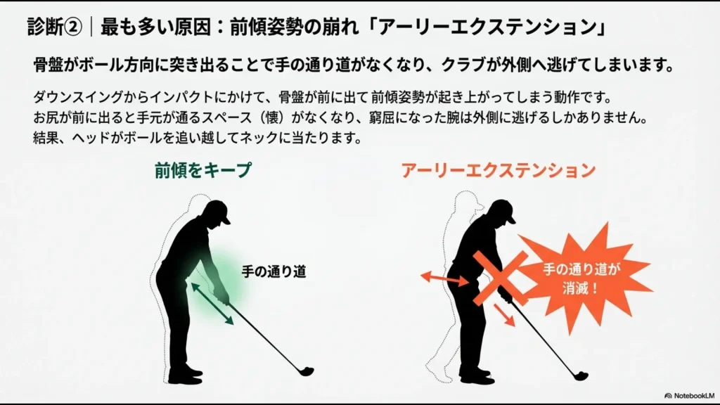 ダウンスイングで骨盤が前に出ることで前傾姿勢が崩れ、手の通り道がなくなってヘッドが外側に逃げる図解